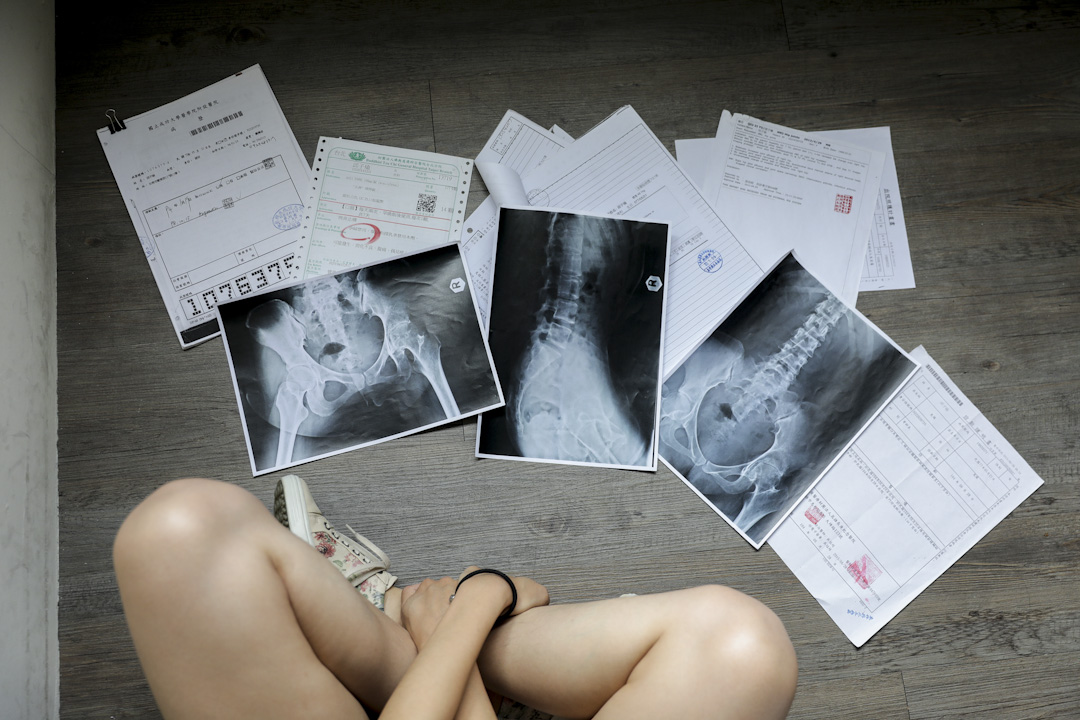 當年,那位披頭散髮、白著一張臉的護士為邱子瑜注射類固醇的那一刻,宣告了接下來長達12年的困獸之鬥。圖為邱子瑜多年來四處求醫累積的病例和X光片。