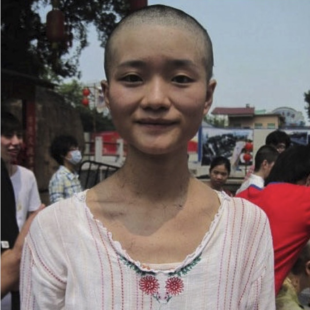 因高考招生性別歧視,四個女生去剃光頭,除打破女性的性別模式,同時和男權審美做一個切斷。這個行動非常成功,此後教育部出台規定,除軍事國防和公共安全等少數專業之外,高校不得自定對男女分數的區別對待。