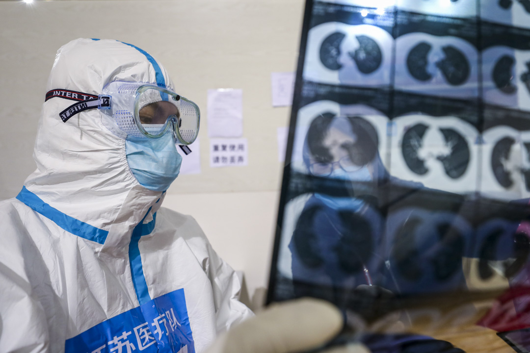2020年3月5日，一名医护人员在分析一名新冠肺炎患者的肺部电脑切片扫描。