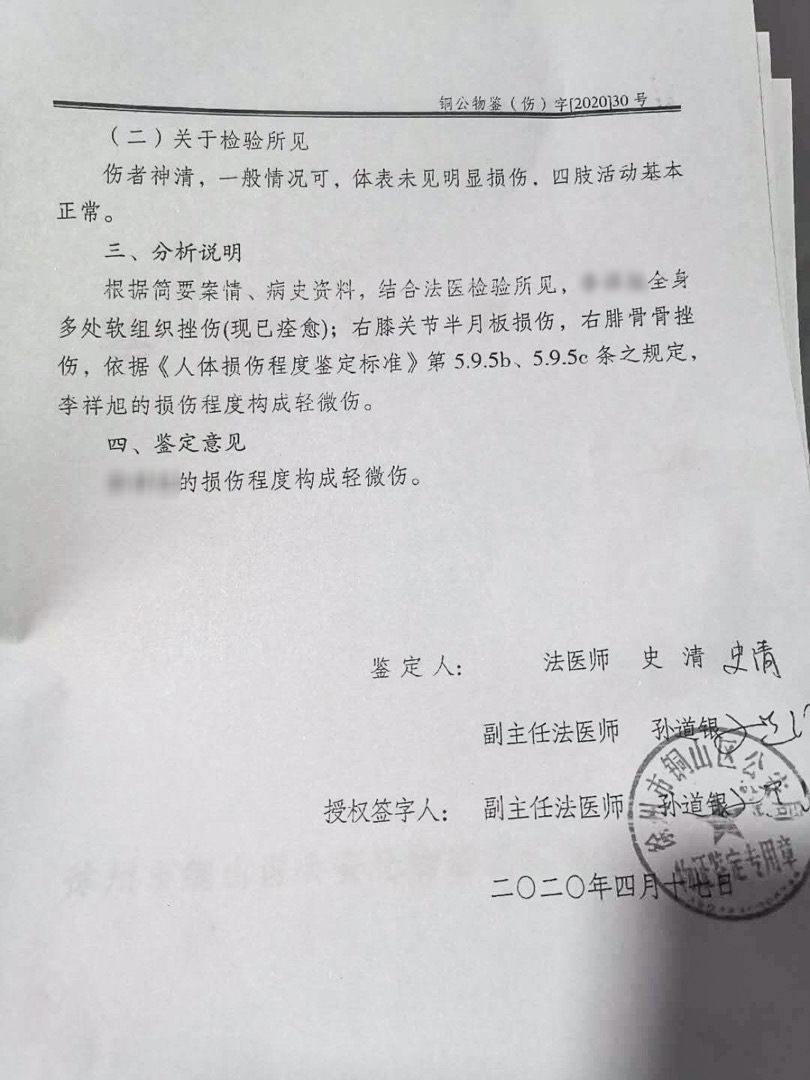 李小明在當地法醫門診做了傷情鑑定。據報告顯示:李小明全身多處軟組織挫傷(現已痊癒);右膝關節半月板損傷,右腓骨骨挫傷,鑑定為輕微傷。