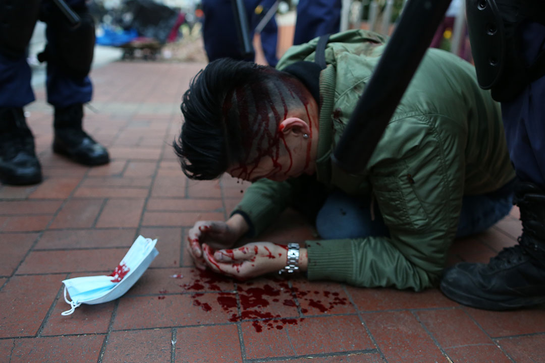 清晨7時,警方在旺角清場期間,一名示威者在山東街近洗衣街被警察使用警棍打至頭部流血,倒臥地上,其口罩跌在身旁。攝:盧翊銘/端傳媒